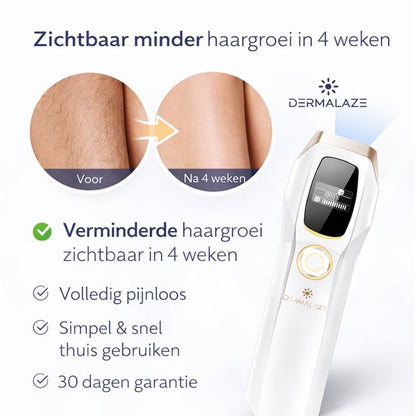 Dermalaze IPL Ontharingsapparaat – IPL Laser voor Permanente Haarverwijdering – Voor Mannen & Vrouwen – Pijnloos Thuisgebruik – Met LED Scherm –1.000.000 Flitsen – Scheermes – Beschermbril – 10 Standen – Ontharingsapparaten