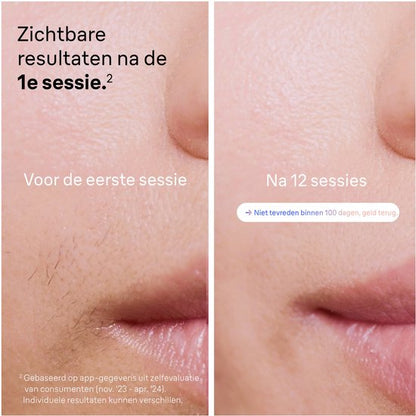 Braun Smart PL7253 Skin i·expert - IPL Ontharingsapparaat - inclusief Etui, Venus Scheersysteem en 3 Koppen