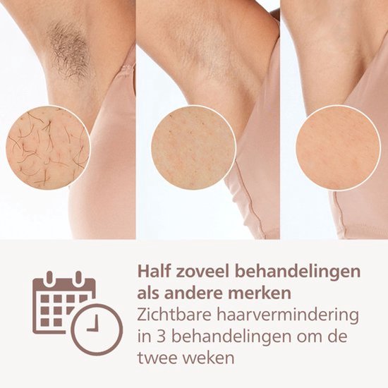 Philips Lumea IPL 9900 Series - IPL Ontharingsapparaat - AI haarvermindering analyse - 2 opzetstukken - Draadloos - BRI950/02
