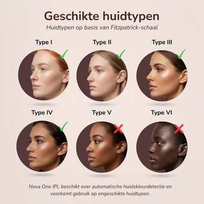 Laesera Nova One IPL Ontharingsapparaat – Laser Ontharing Thuis – Met Koelfunctie & Huidsensor