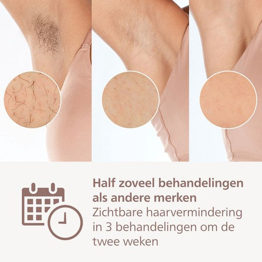 Philips Lumea IPL 9900 Series - IPL Ontharingsapparaat - AI haarvermindering analyse - 4 opzetstukken - BRI951/01
