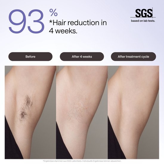 Ulike - Air 3 - Paars - Laser Ontharing Apparaat - IPL Ontharing voor Vrouwen en Mannen met Saffier Ice Cooling - Bijna pijnloos - Langdurige Resultaten voor Gezicht en Lichaam - Geschenkdoos